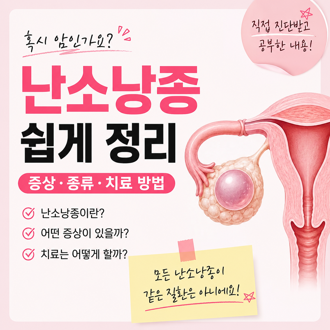 난소낭종이란? 증상부터 원인, 치료와 수술 기준까지 쉽게 정리