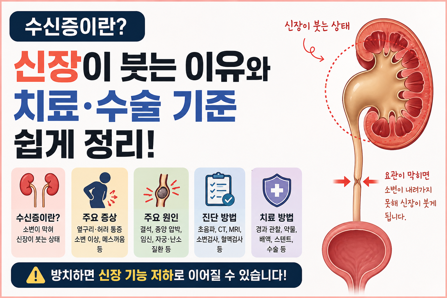 수신증이란? 증상부터 원인, 치료와 수술 기준까지 쉽게 정리